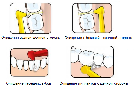 Использование ершика для зубов