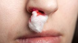 Кровяные корки в носу: причины, клиническая картина, методы лечения