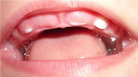 кашель и прорезывание зубов