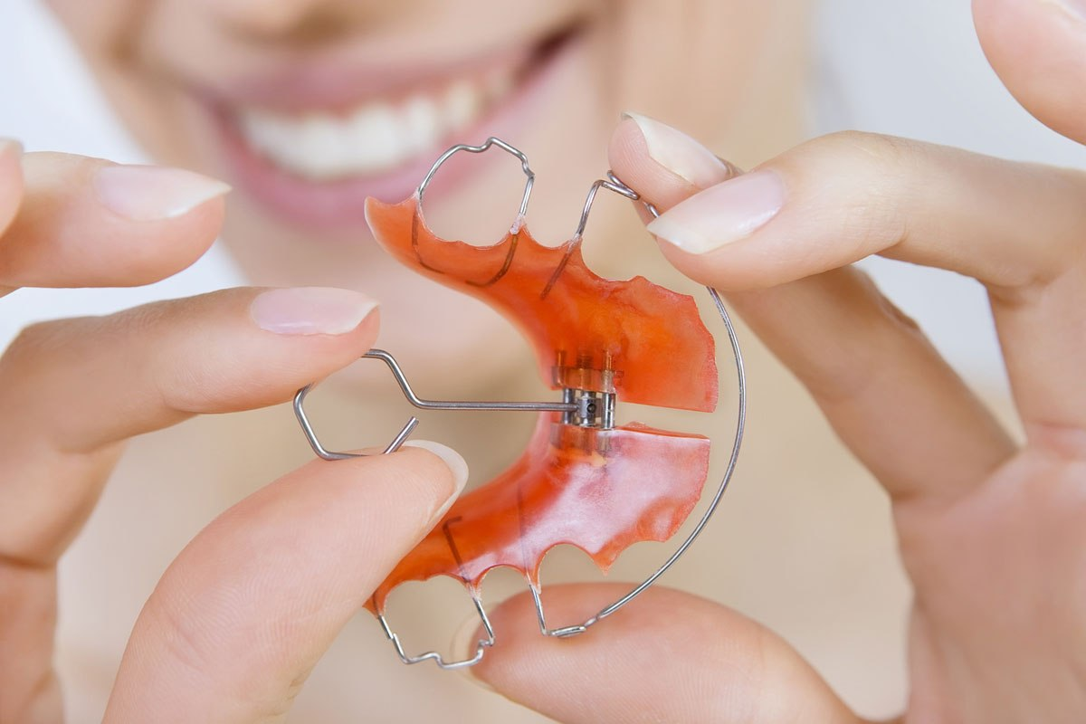 Ортодонтические пластины для выравнивая зубов