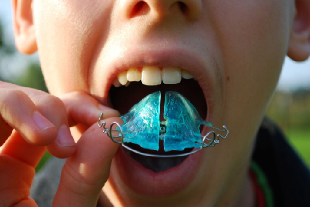 Зубная пластина для детей фото
