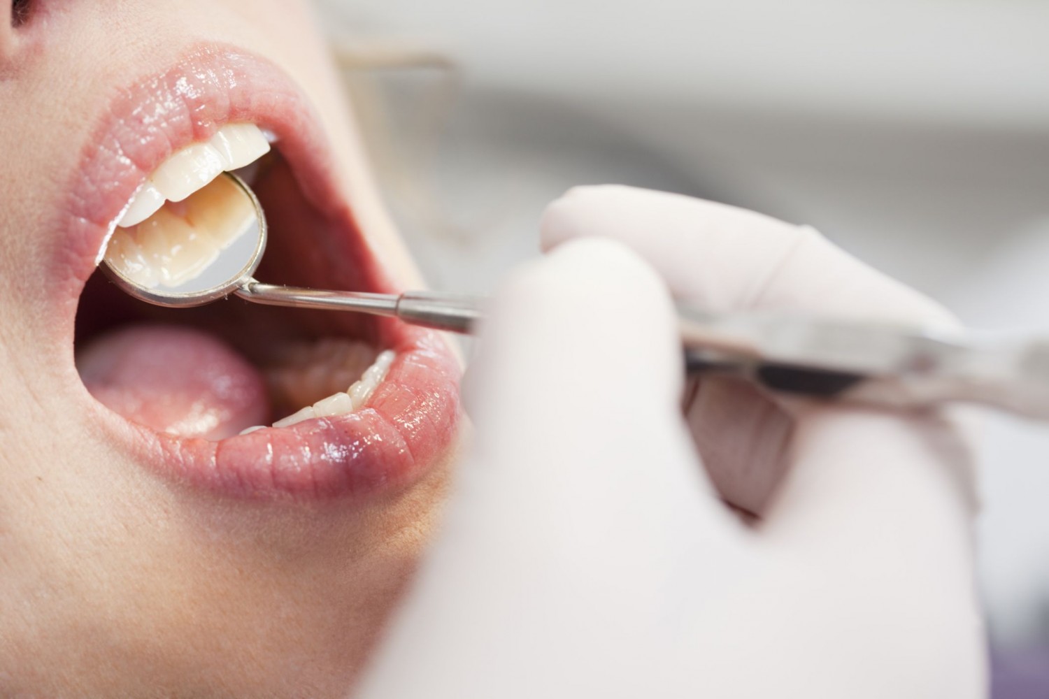 Стоматологические болезни как причины запаха кала изо рта