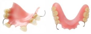 частичный акриловый зубной протез