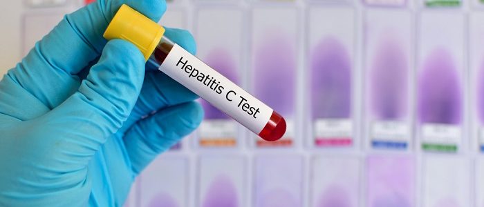 Анализы на гепатит Б