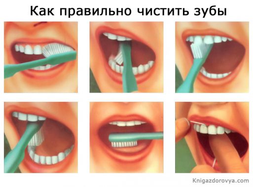 чистка зубов