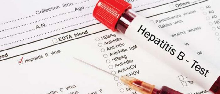 Симптомы гепатита Б