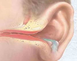 Закладывает ухо при насморке – что делать, причины и лечение