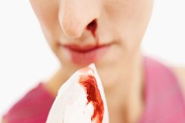 Почему идет кровь из носа утром, и что делать?