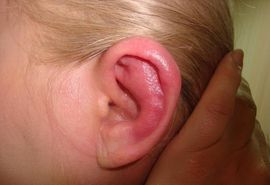 Мокнет за ухом: причины, симптомы и методы лечения