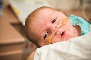Фототерапия для новорожденных при желтухе