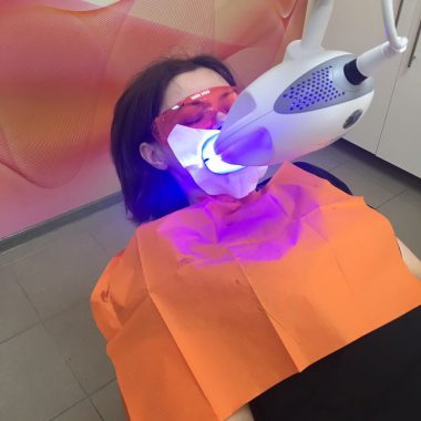 отбеливание в кабинете стоматолога