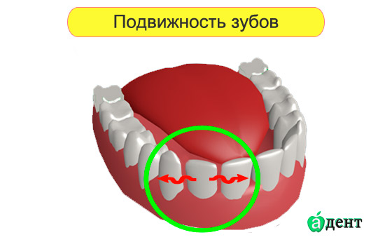 подвижность зубов при нехватке витаминов