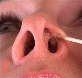 Трещины в носу: причины и методы лечения, чем мазать