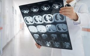 МРТ тканей печени