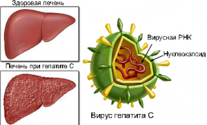 Неактивный гепатит С